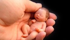 РПЦ виступає за виведення абортів з обов'язкового страхування