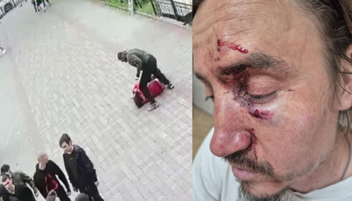 Ιερέας της UOC, πατήρ Ρομάν, ξυλοκοπήθηκε από μαχητές δίπλα στον καθεδρικό ναό στο Τσερνιβτσί. Φωτογραφία: ΕΟΔ