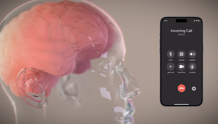 Neuralink обещает слияние сознания с ИИ. Фото: Neuralink