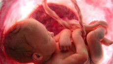 Η άμβλωση έγινε η κύρια αιτία θανάτου στον κόσμο το 2025, σύμφωνα με στατιστικά στοιχεία του ΠΟΥ