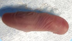 В США выращивают эмбрионы для пересадки органов без мозга и конечностей